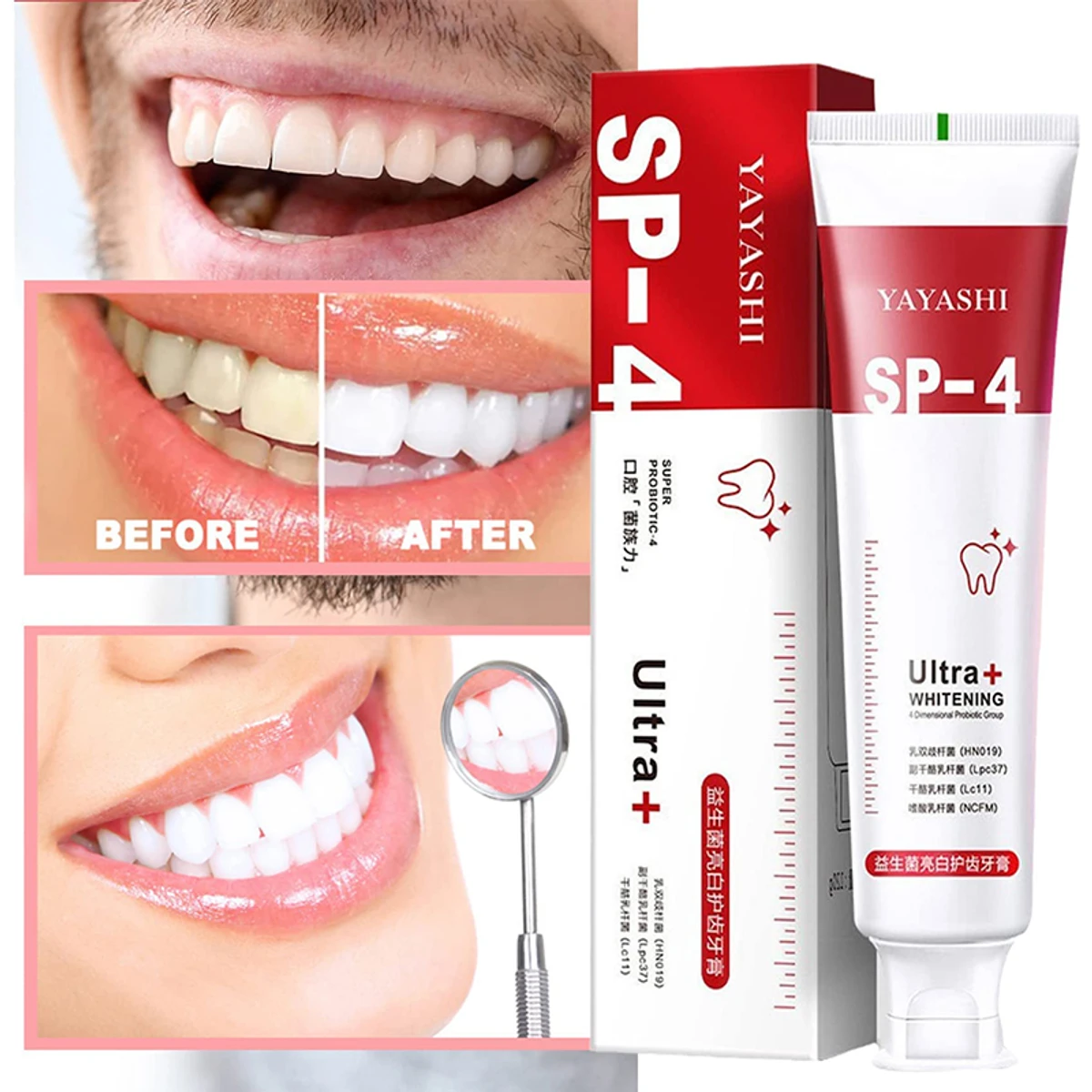 Super Probiotic-4 Whitening Toothpaste (১০০% গ্যারান্টি কার্যকরী টুথপেস্ট)