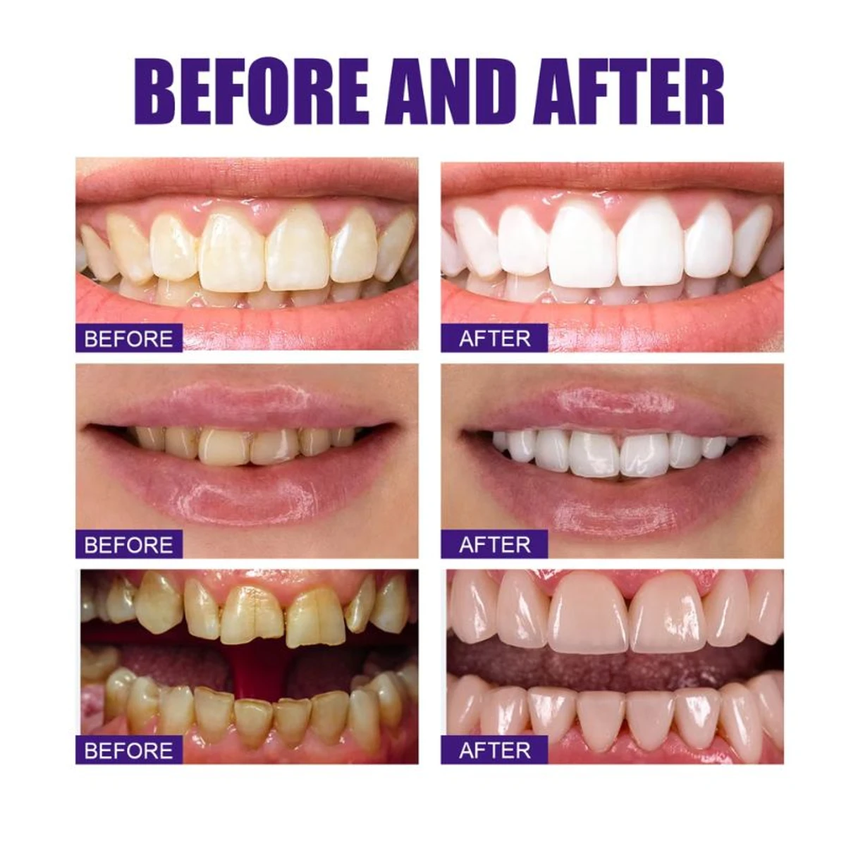 Super Probiotic-4 Whitening Toothpaste (১০০% গ্যারান্টি কার্যকরী টুথপেস্ট)